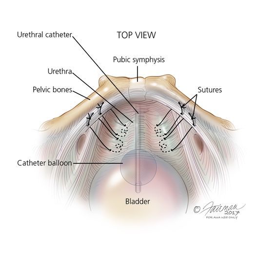 female urologist