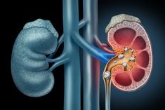 female urologist