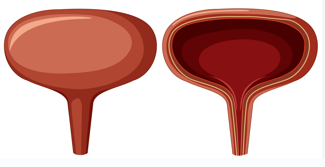 Overactive Bladder: Causes, Symptoms, and Management