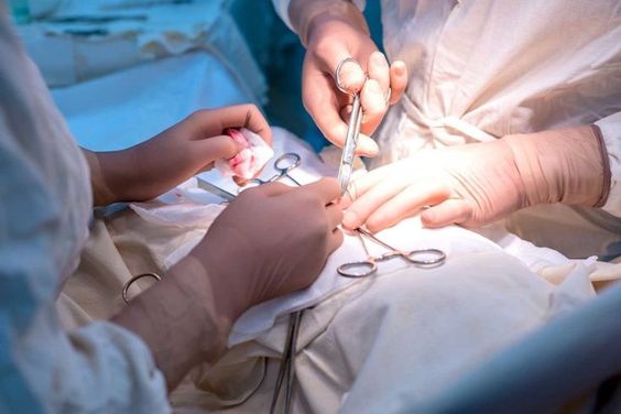 A urogynaecologist female urologist: What Is It? When to See One, What They Do, and What to Anticipate: