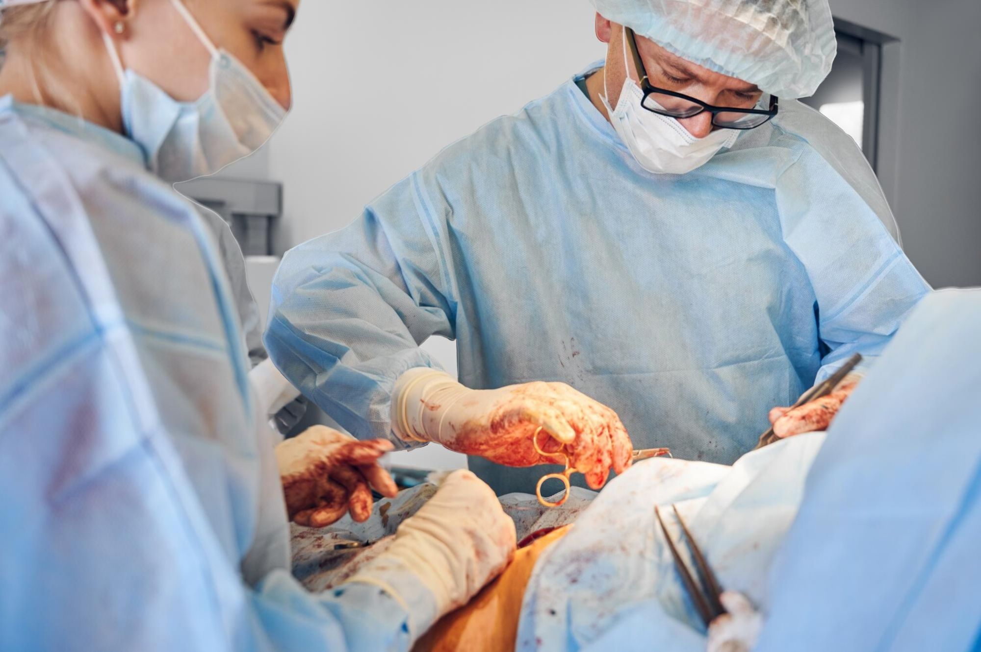  Bladder Cancer?